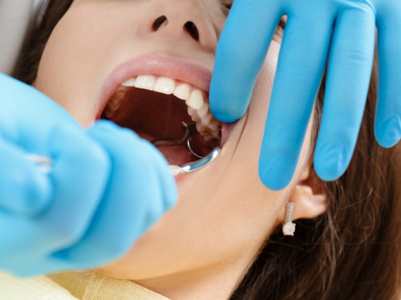 Emergency tooth extraction when a dental emergency&nbsp;occurs